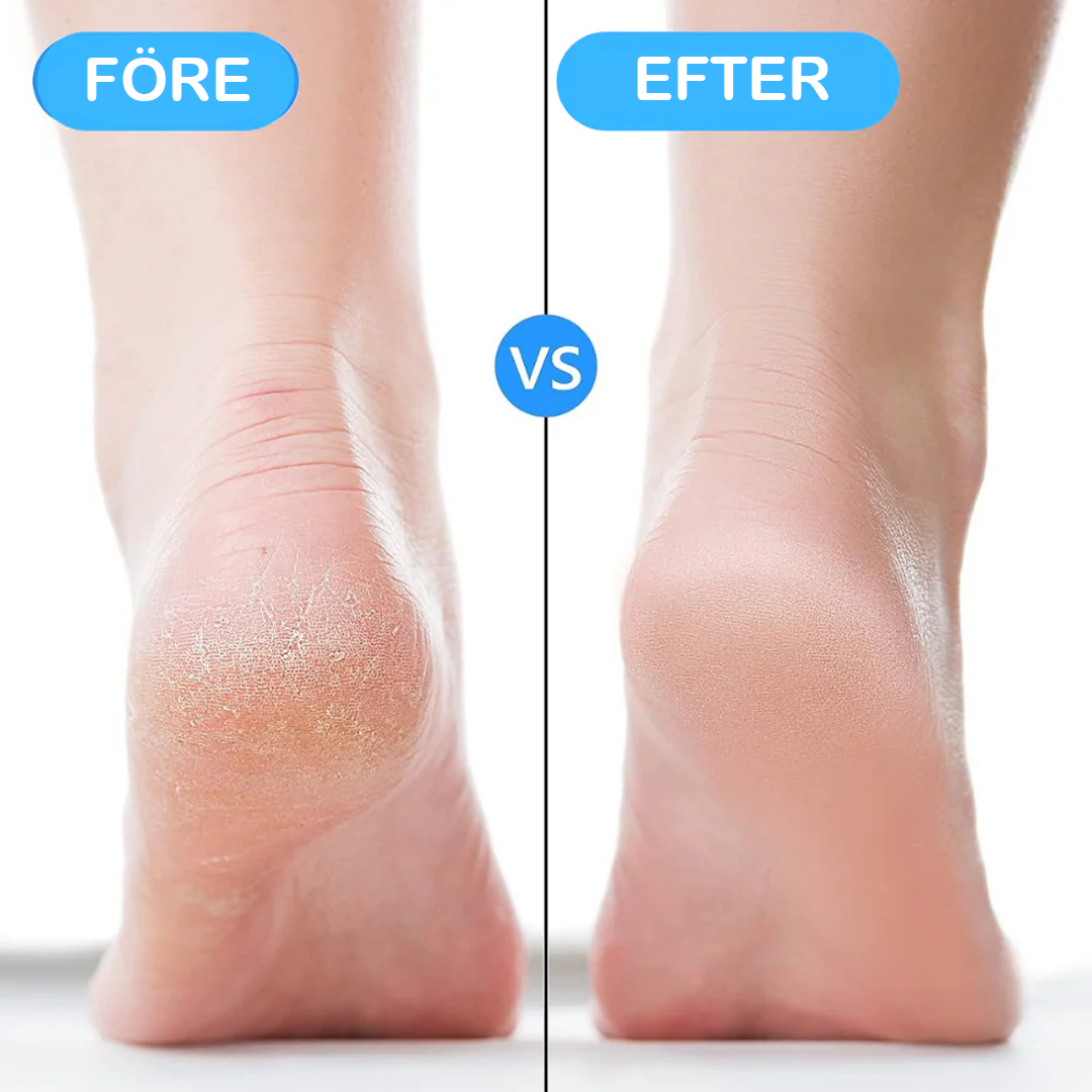 ComfyStep™ - Avlastande Hälskydd